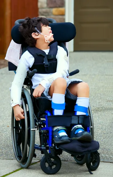 7-летний мальчик две расы инвалидов в коляске — стоковое фото